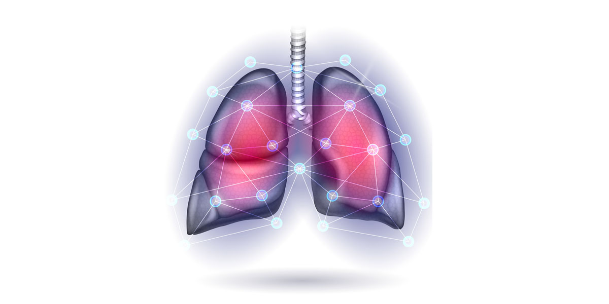 Actualización en el manejo de la hipertensión pulmonar a través de casos clínicos
